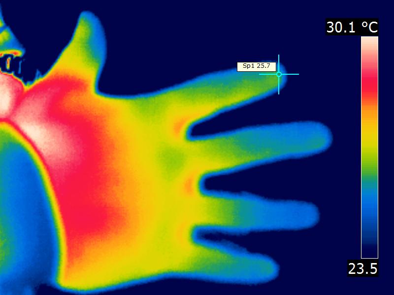 KHB Wrmebild Hand